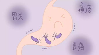 hp现症感染怎么治疗，如何治疗幽门螺杆菌