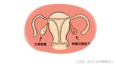 卵巢储备功能下降是什么意思？，什么是卵巢储备功能不足