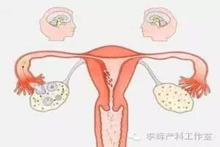 卵巢功能好的人试管一般用什么方案，做试管婴儿一般会用什么方案