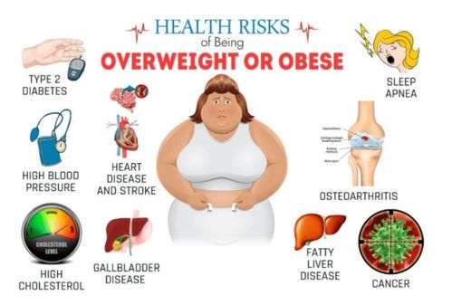 肥胖代谢性疾病有哪些，肥胖会引发什么疾病